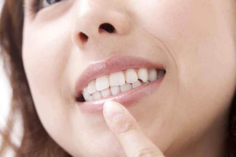 脱灰が起こりやすい口腔内環境～むし歯のリスク検査～